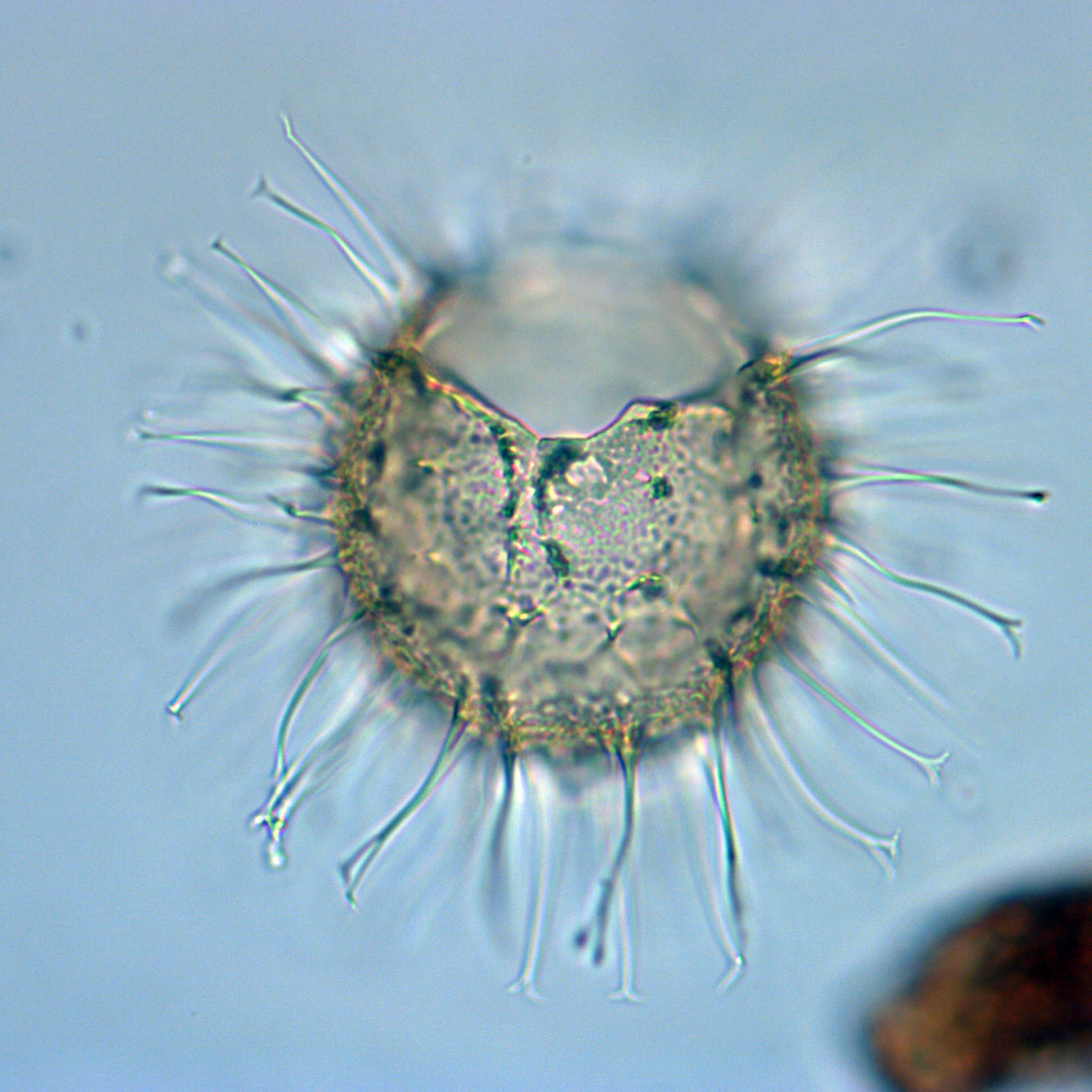 Cleistosphaeridium diversispinosum, 1410C-8H-4, 65-67, R37-4, foto-d.jpg